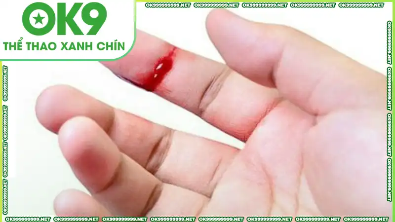 Mỗi kiểu thấy máu đi kèm với dàn số lộc lá khác nhau Mỗi kiểu thấy máu đi kèm với dàn số lộc lá khác nhau